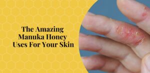 The-Amazing-Manuka-Honey-Uses-For-Your-Skin-Bee-Confident